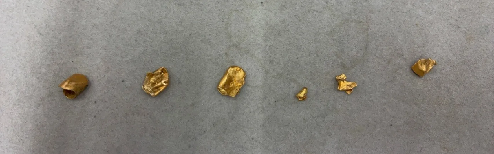 【金歯の買取実績】外れた金歯、歯肉・樹脂がついたままの状態でも高価買取いたします！